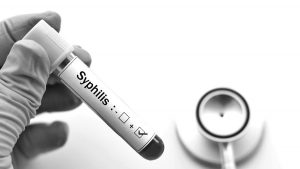 sifilis-enfermedad-argentina